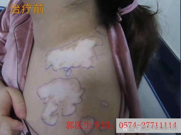 �ϳ����ư�������ЩҽԺ ����೤ʱ����ɢ