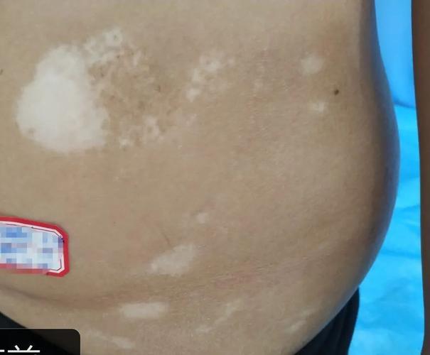 Ϊʲô��������������� ��������ЩҽԺ�����ư���