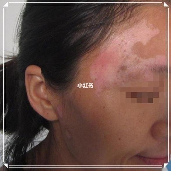 �ڶ��Ͱ�����ô�� ���������ư����ҽԺ