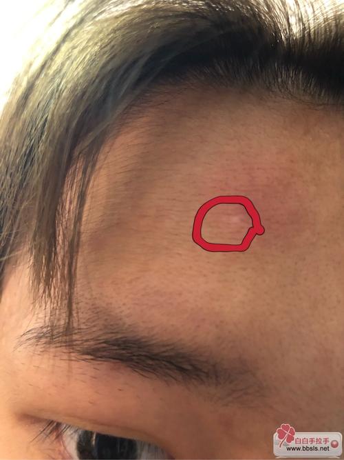 �����ΰ��� �������