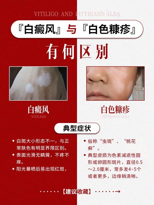 �Ͼ��õ����ư����ҽԺ ��ҽ���ư���ķ�������Щ