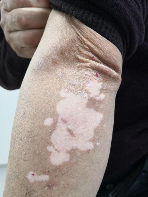 ������ô�ڸǵ� �����ڸ�����