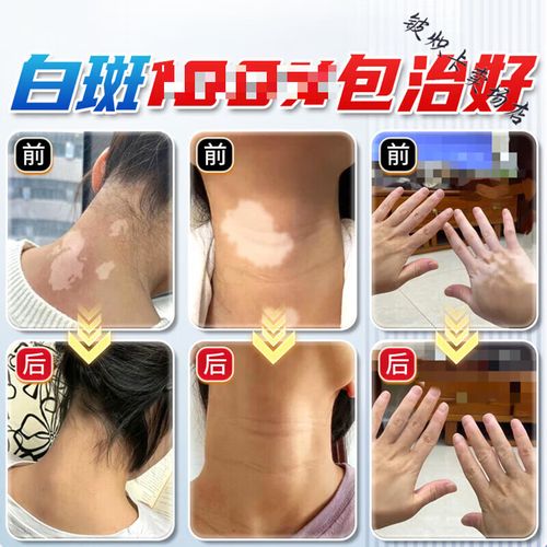 �����ܰ� ��ɽ���ư���ҽԺ�����Ƽ��װ���λ���