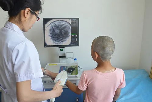 广州哪里医院治疗白癜风好 白癜风对免疫系统的危害有哪些呢 广州哪里医院治疗白癜风好 白癜风对免疫系统的危害有哪些呢