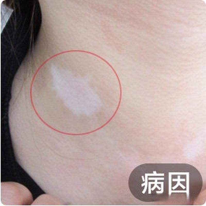 10���ͯ��������ô��