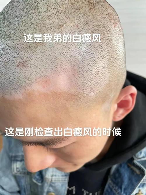 ���ʶ�����֢״ ������������ҽԺ�ļ�רҵ