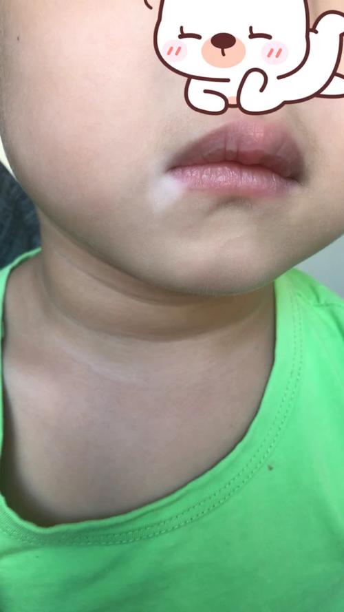 μ�ϰ��综��_�������ư������