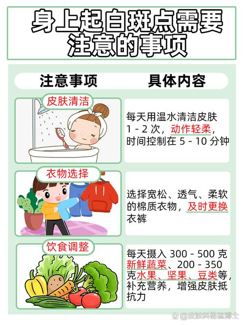 东方治疗白癜风的医院 东方治疗白癜风的医院