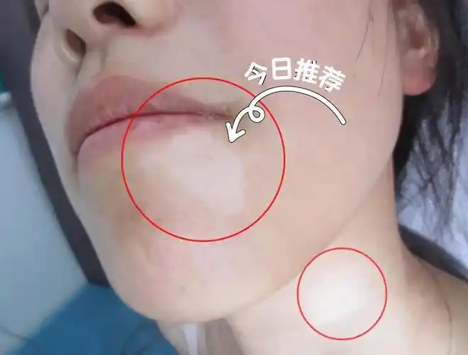 ��������Щ�ΰ����ҽԺ ����ע������