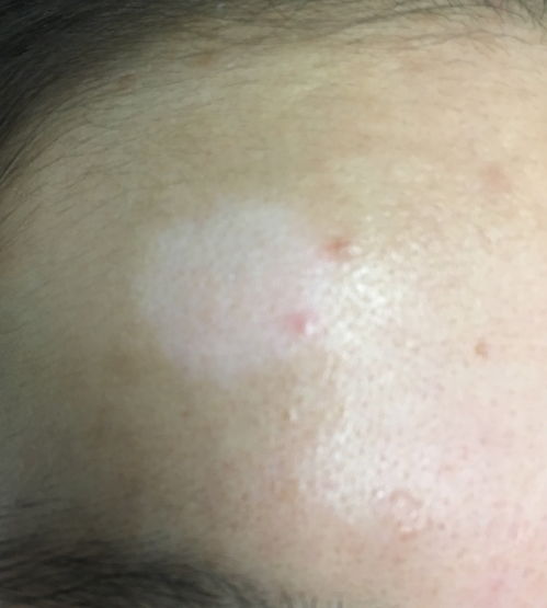 ����ľ������ľ����ʲôҩ����