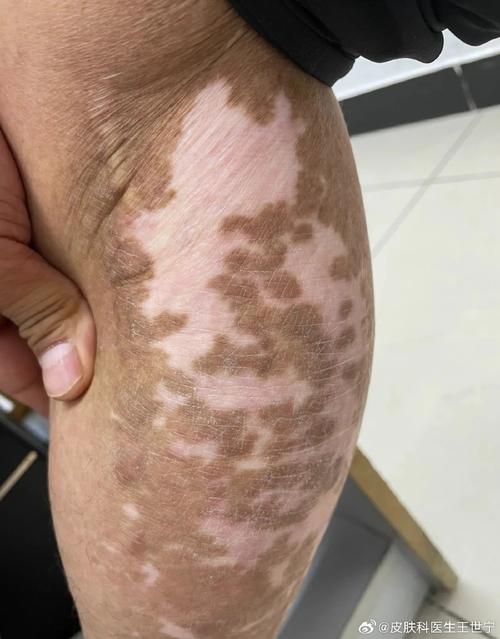 ��������λ���ţ��