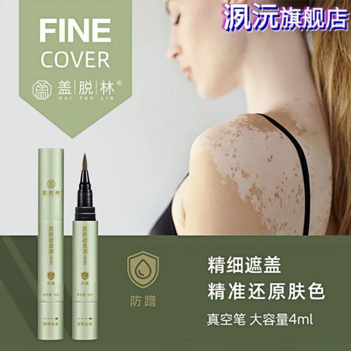 岁数大还会得白癜风吗 黄山治疗白癜风有效果的医院 岁数大还会得白癜风吗 黄山治疗白癜风有效果的医院