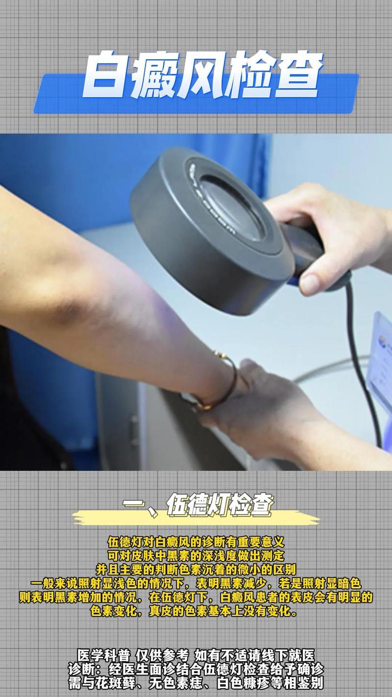 �����ΰ�����÷���