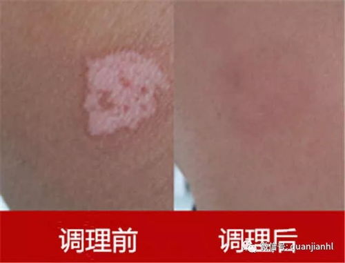 ������΢����������״