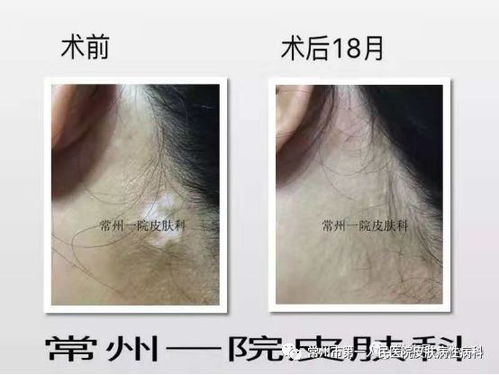 �����˲���Ա��83��