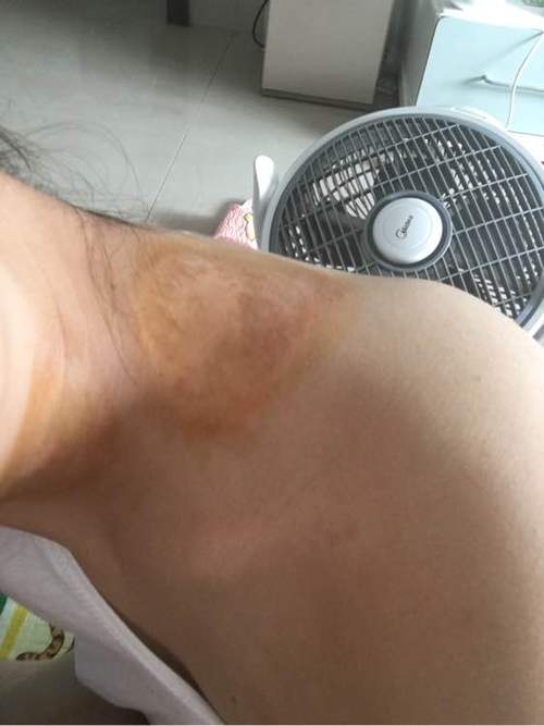 ��μ�ǿ���԰�������Ĺ������� �����ΰ����ҽԺ�����