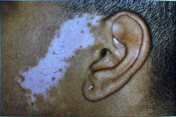 �������ӿ�������ֱ��