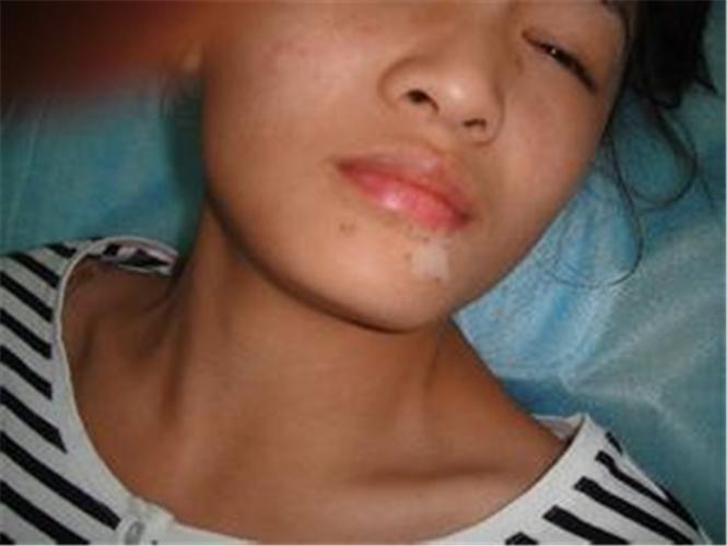 ���综����Ҫ֪������ʳ���� �������ư���ҽԺ�м���