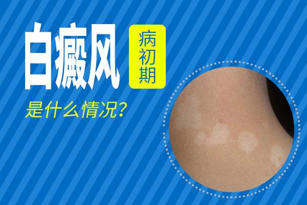 ����ͷ������ ����ͷ��