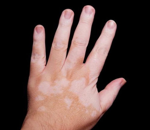 ͨΰҽԺЩ ΪʲôҪѪҺ