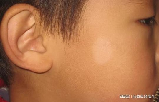 ͷƤ����������� �����������ư����ҽԺ��