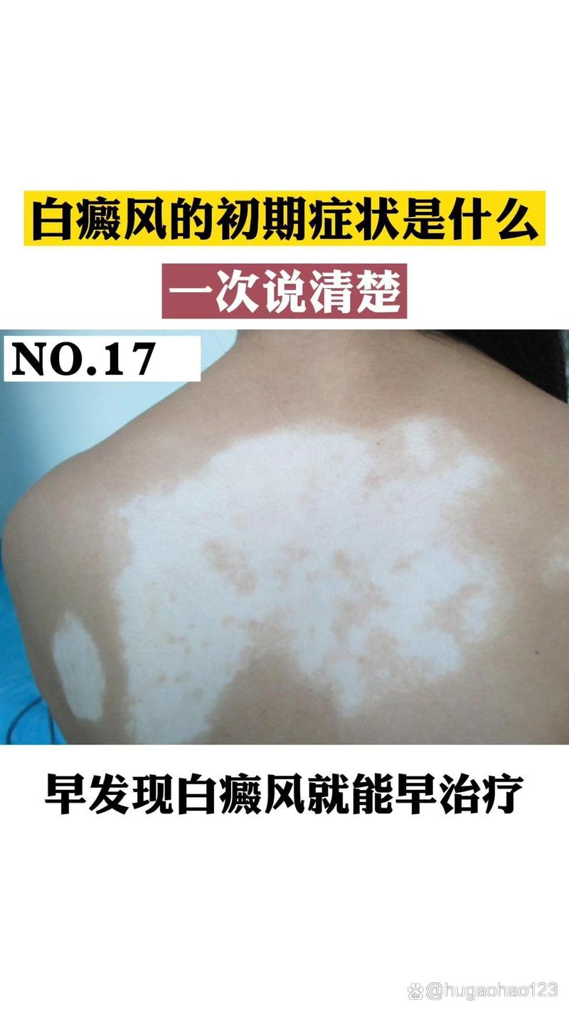 ʱ���ȵ� ��ɽ���ư���ҽԺ�����רҵ�������Ʒ����ƶ�ͯ����Ч�����