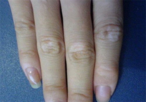 �����Ƿ���Ҫ���� �����β���