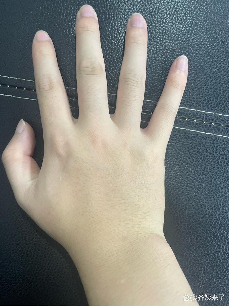 �����Ǽ�ҽԺ���װ߿��ĺ� ����Խ��Խ�׵�ԭ������Щ