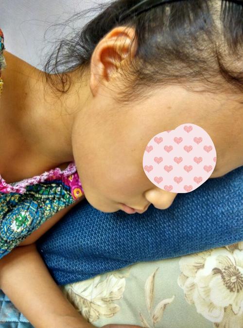 白癜风前期如何能治愈 白癜风前期如何能治愈