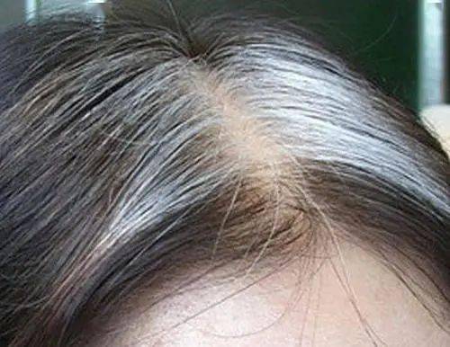 白癜风的有效治疗方法有哪些 宁波哪家医院能治好白癜风 白癜风的有效治疗方法有哪些 宁波哪家医院能治好白癜风