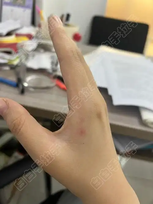 ����ע������ �Ϻ���רҵ�ΰ���ҽԺ��