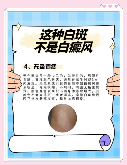 ������ó�۷���ڼ� ���ݺ�Ͽ�ͻ���������