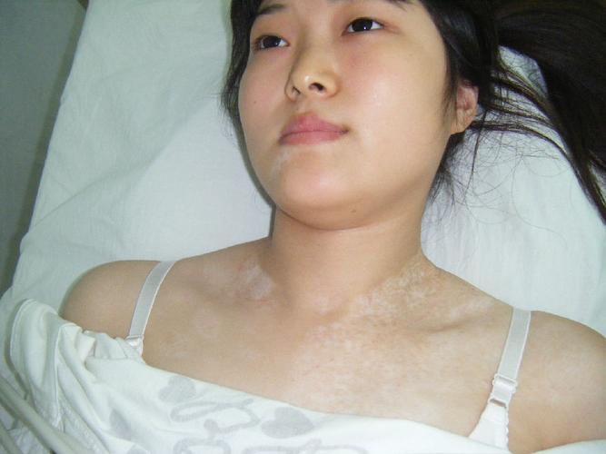 ��ѹic_��ѹic��ʲô