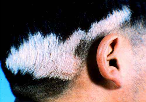 �����ļ�ҽԺ����ҽ���� Ӧ�ü������ư���Ӧע����Щ����