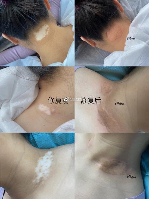 �����ڸǰ����ɫ��