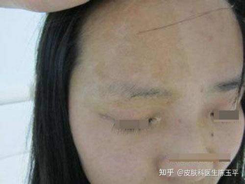 爱情公寓陈赫 爱情公寓陈赫吻戏 爱情公寓陈赫 爱情公寓陈赫吻戏