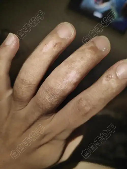 ����������Ƭ�����а�