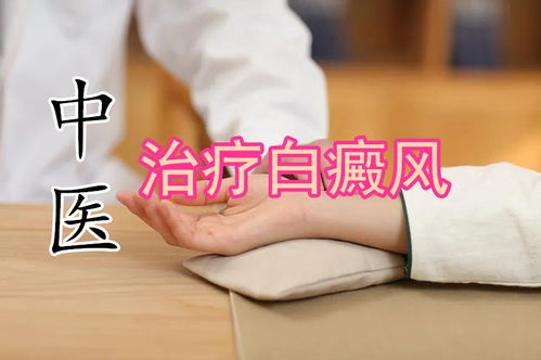 菏泽哪家治疗白癜风较好 菏泽哪家治疗白癜风较好