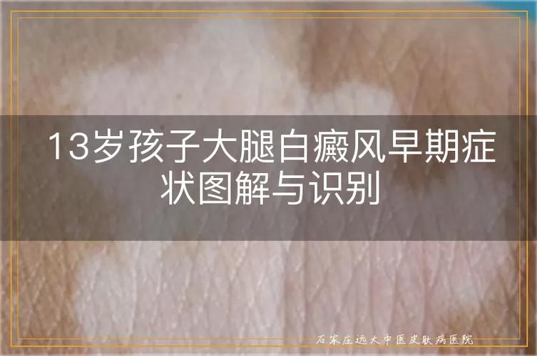 ʲô�����ư��� �ĵ������簸��