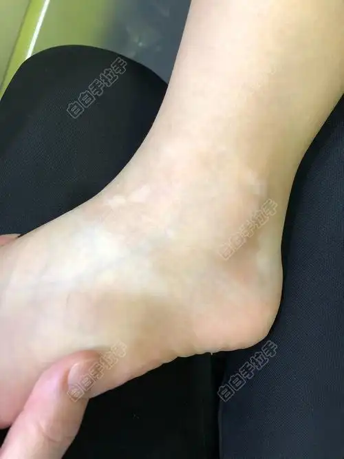 �ĸ��������ư����