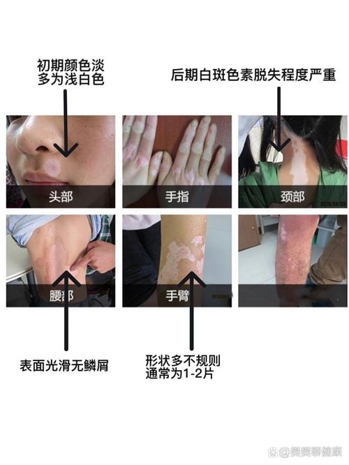 �������ƶ�ͯ������ɢ