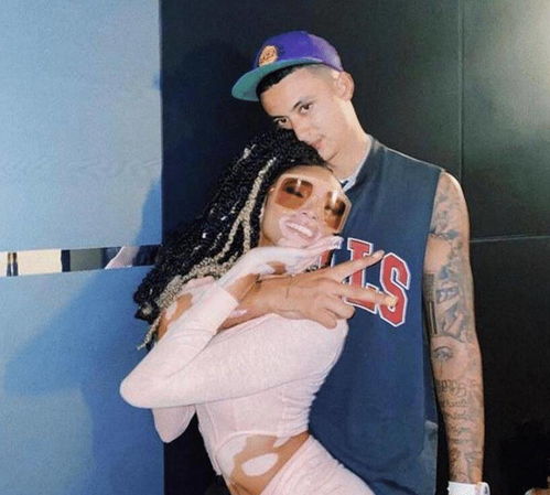 补骨脂加什么治疗白癜风 补骨脂加什么治疗白癜风