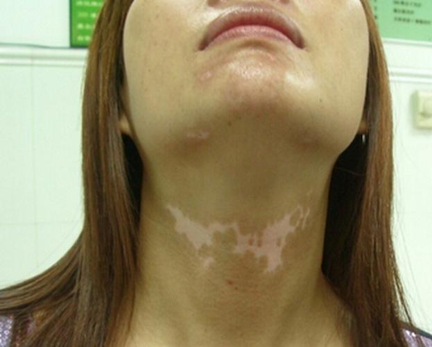 ��ɳ�ļ�ҽԺ���ư���ð�����ô����