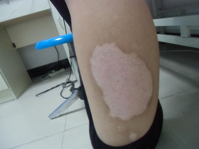 ��Ҷˮ�������ư���