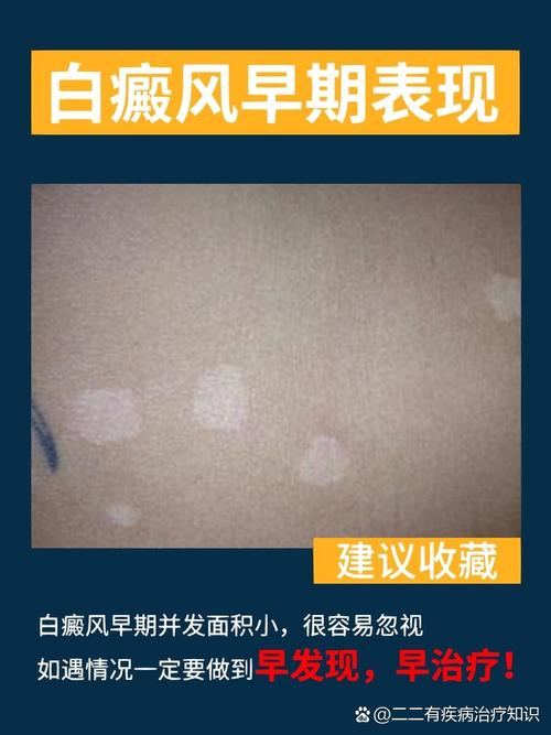 ʲôԭ���������� �ɶ����ư��� ��ҽԺ