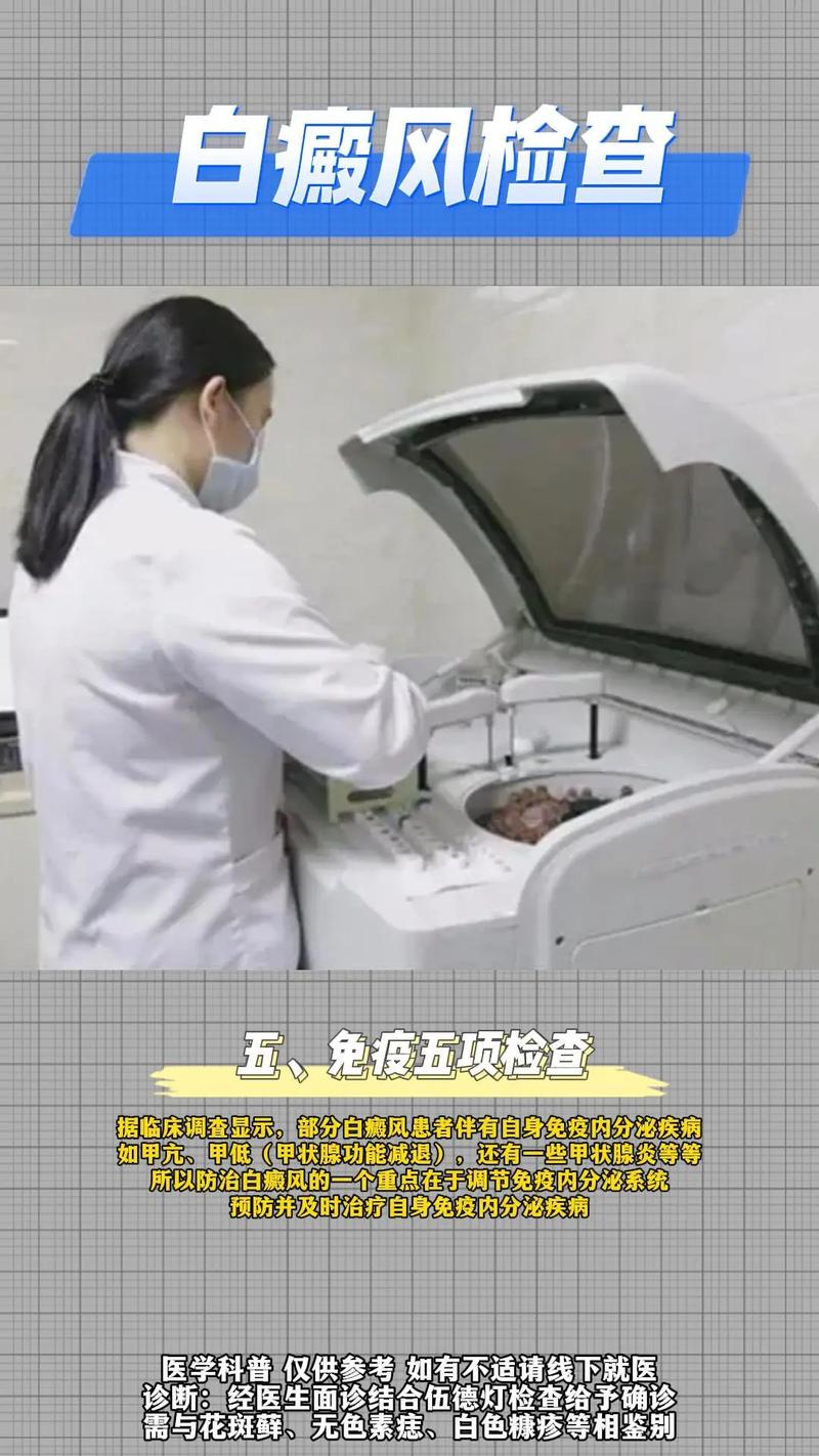 郑州西京白癜风医院是什么级别的 长期服用白癜风药物有哪些副作用 郑州西京白癜风医院是什么级别的 长期服用白癜风药物有哪些副作用