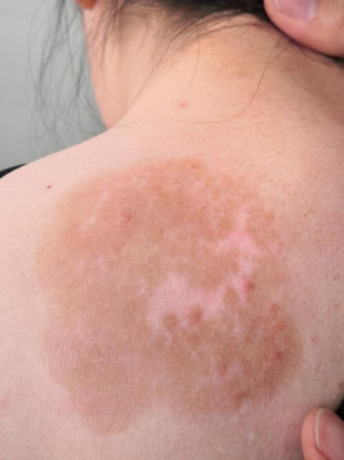 ���������ϰ�ҽ�������� ����������гҽ����ɶ�����ҽԺ�ٻ� ����ʾ��ҽԺ�ƺ�