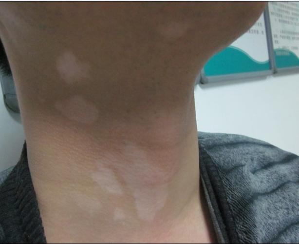 �����������ư����