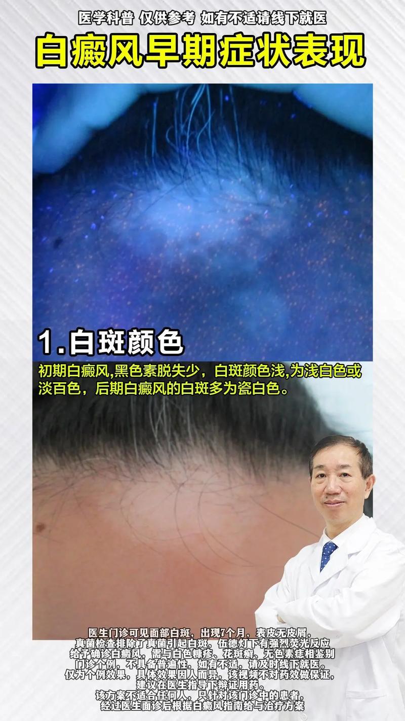 �����Ч�������֢״ �������ΰ����ҽԺ����