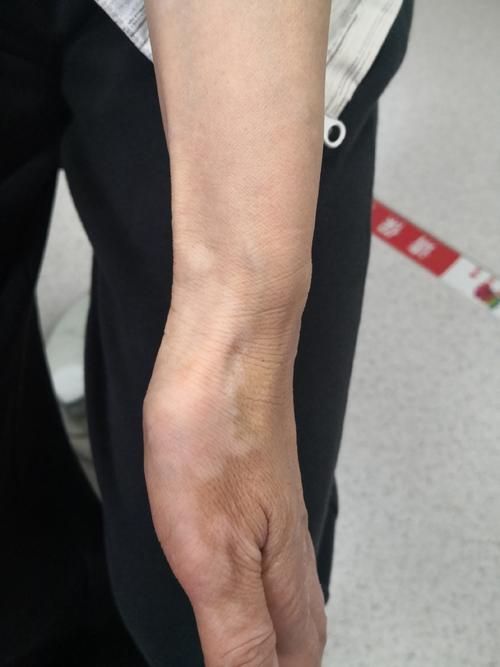 ���ĵ�������Ĺ�Ч